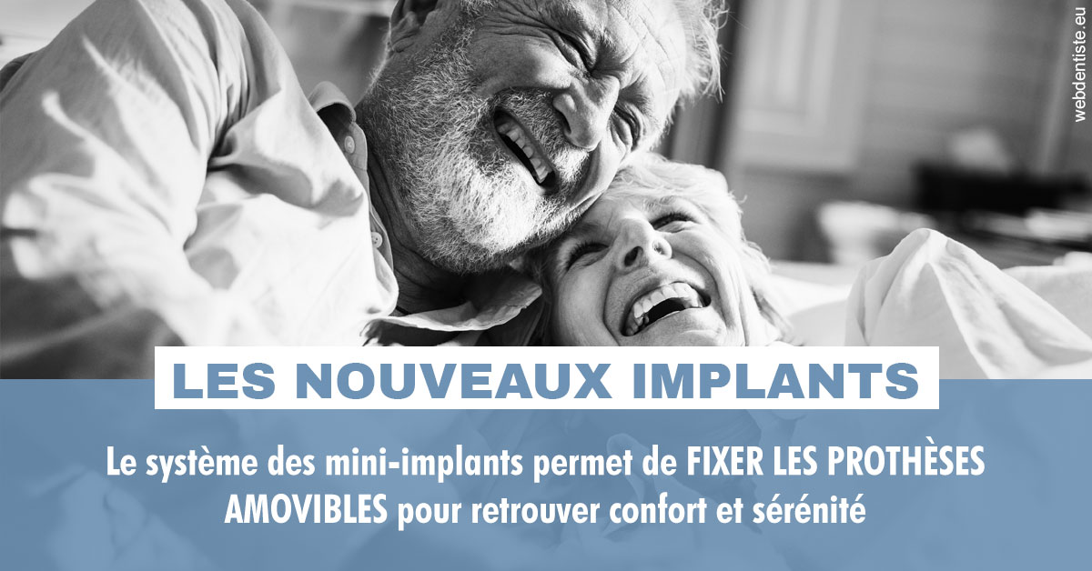 https://dr-benichou-laurence.chirurgiens-dentistes.fr/Les nouveaux implants 2