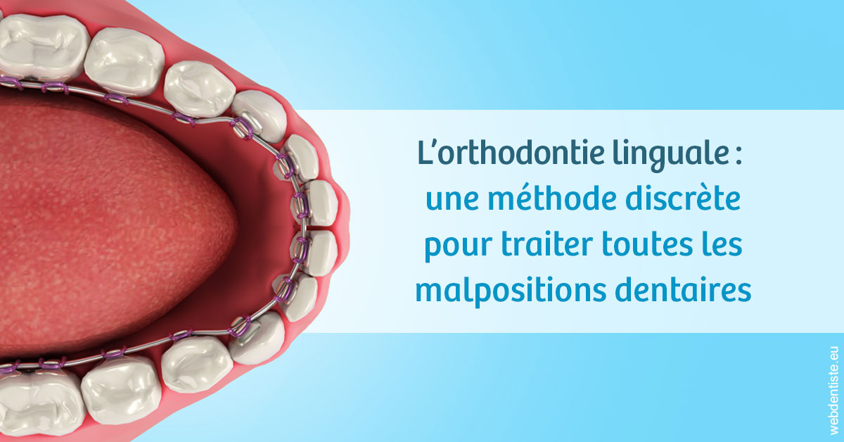 https://dr-benichou-laurence.chirurgiens-dentistes.fr/L'orthodontie linguale 1