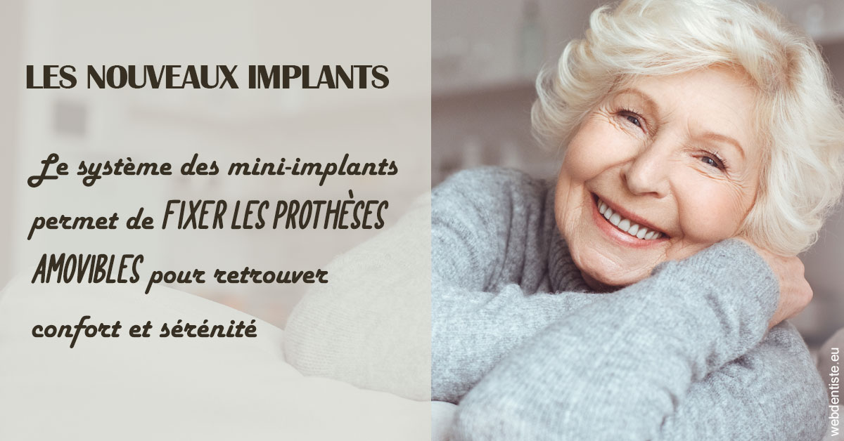 https://dr-benichou-laurence.chirurgiens-dentistes.fr/Les nouveaux implants 1