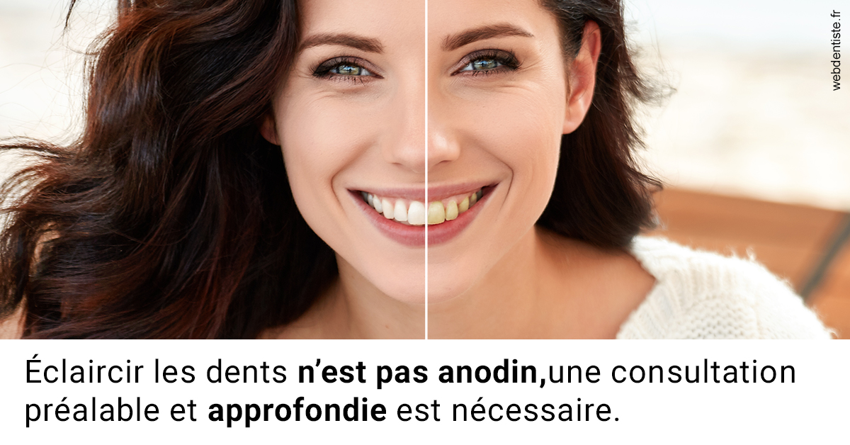 https://dr-benichou-laurence.chirurgiens-dentistes.fr/Le blanchiment 2