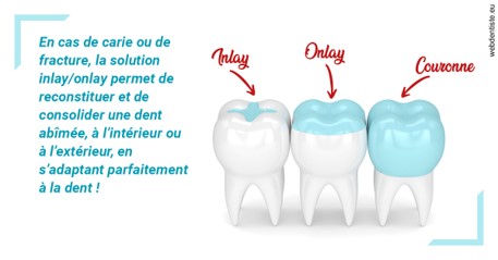 https://dr-benichou-laurence.chirurgiens-dentistes.fr/L'INLAY ou l'ONLAY