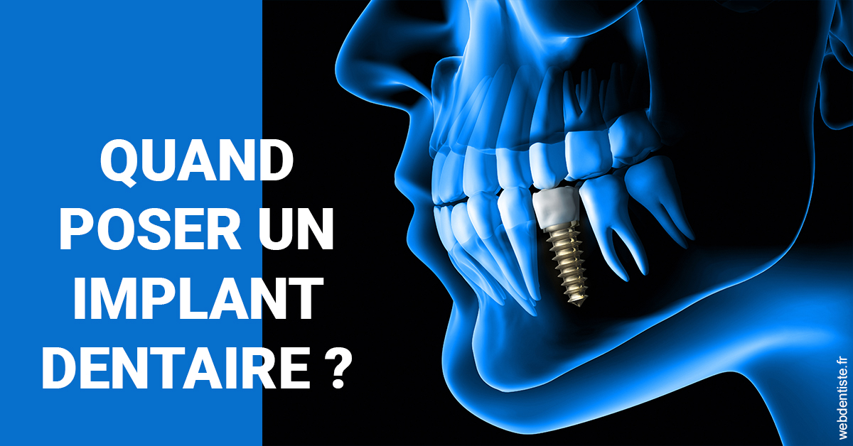 https://dr-benichou-laurence.chirurgiens-dentistes.fr/Les implants 1