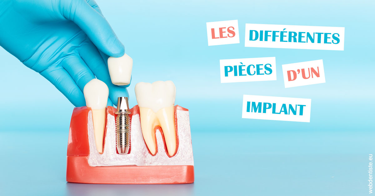 https://dr-benichou-laurence.chirurgiens-dentistes.fr/Les différentes pièces d’un implant 2