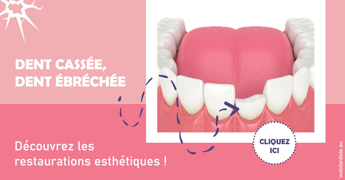 https://dr-benichou-laurence.chirurgiens-dentistes.fr/Dent cassée ébréchée 1