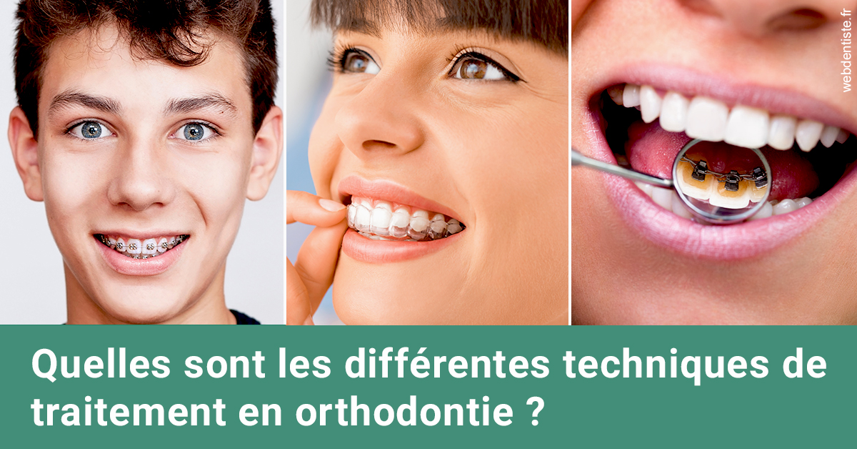https://dr-benichou-laurence.chirurgiens-dentistes.fr/Les différentes techniques de traitement 2