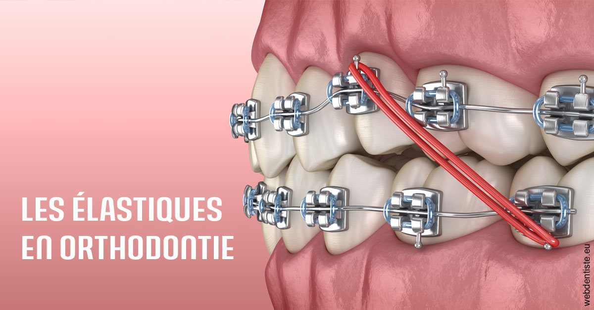 https://dr-benichou-laurence.chirurgiens-dentistes.fr/Elastiques orthodontie 2