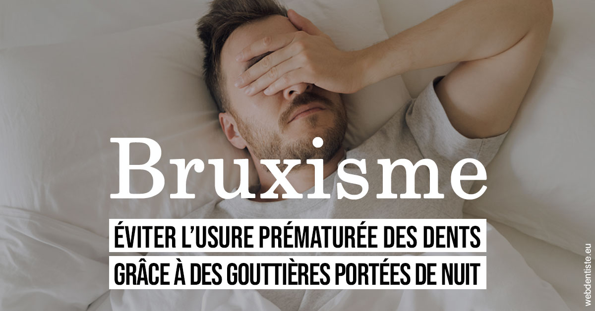 https://dr-benichou-laurence.chirurgiens-dentistes.fr/Bruxisme 1