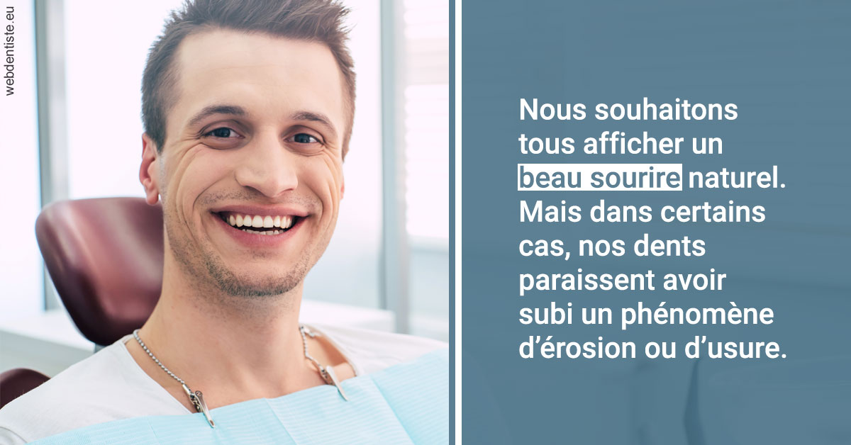 https://dr-benichou-laurence.chirurgiens-dentistes.fr/Érosion et usure dentaire